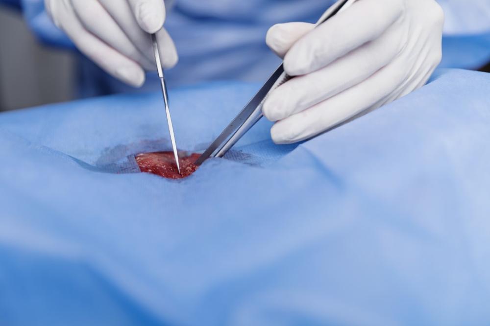 Chirurgie vasculaire à Cholet